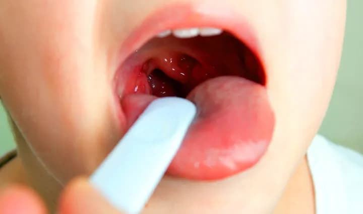 Objawy bólu gardła u niemowlaka – jak je rozpoznać i złagodzić ból