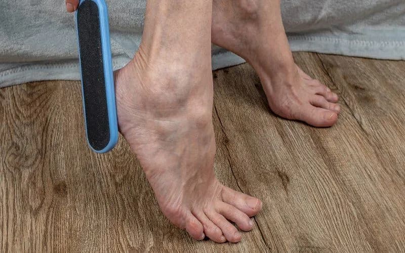 Skuteczne sposoby na otarcia na stopach - zapobieganie i leczenie