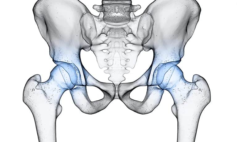 Endoproteza stawu biodrowego NFZ - gdzie najszybciej bez czekania