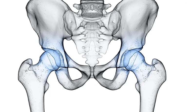 Endoproteza stawu biodrowego NFZ - gdzie najszybciej bez czekania