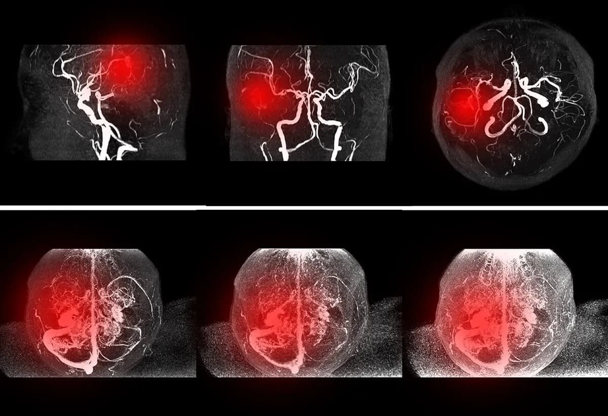 Ból tętnicy szyjnej objawy: co może oznaczać Twój ból?