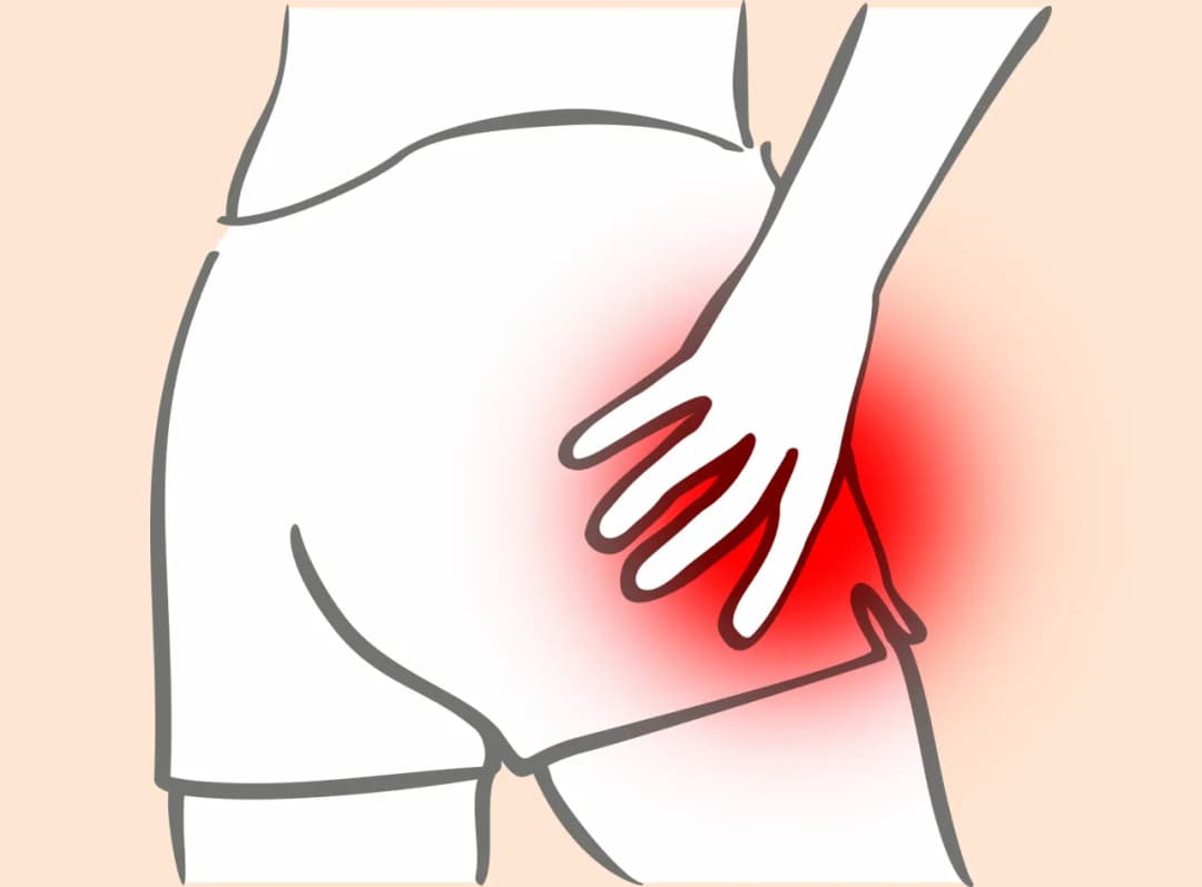 Ból biodra od czego: najczęstsze przyczyny i jak je złagodzić