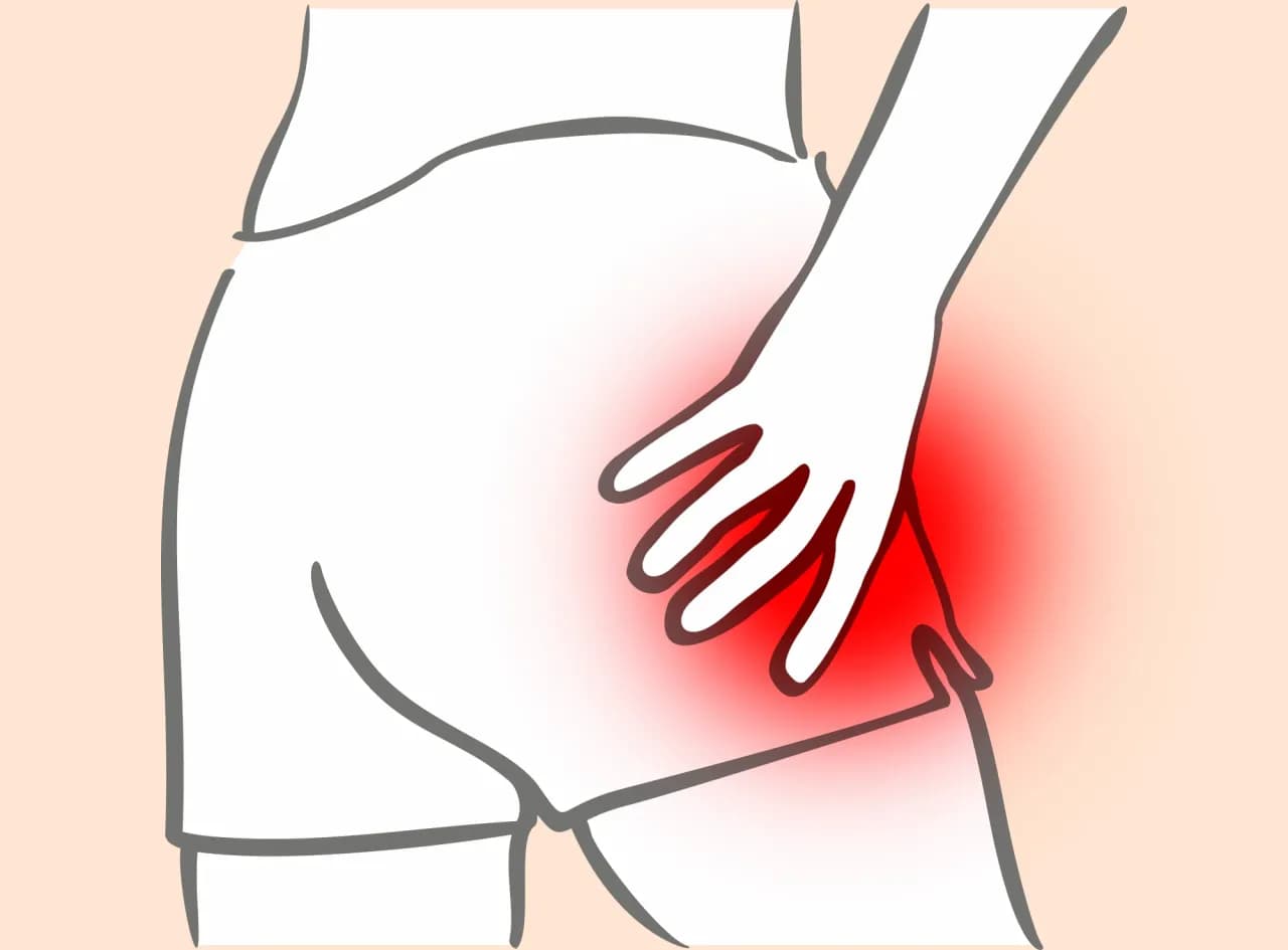 Ból biodra od czego: najczęstsze przyczyny i jak je złagodzić