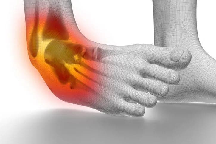 Ile czasu goi się skręcenie stawu skokowego? Poznaj kluczowe informacje