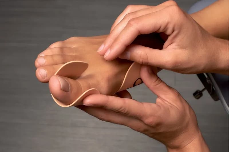 Jakie wkładki na haluksy są najskuteczniejsze w łagodzeniu bólu?