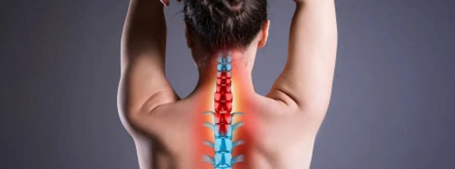 Skręcenie kręgosłupa szyjnego - ile trwa leczenie i co wpływa na powrót do zdrowia
