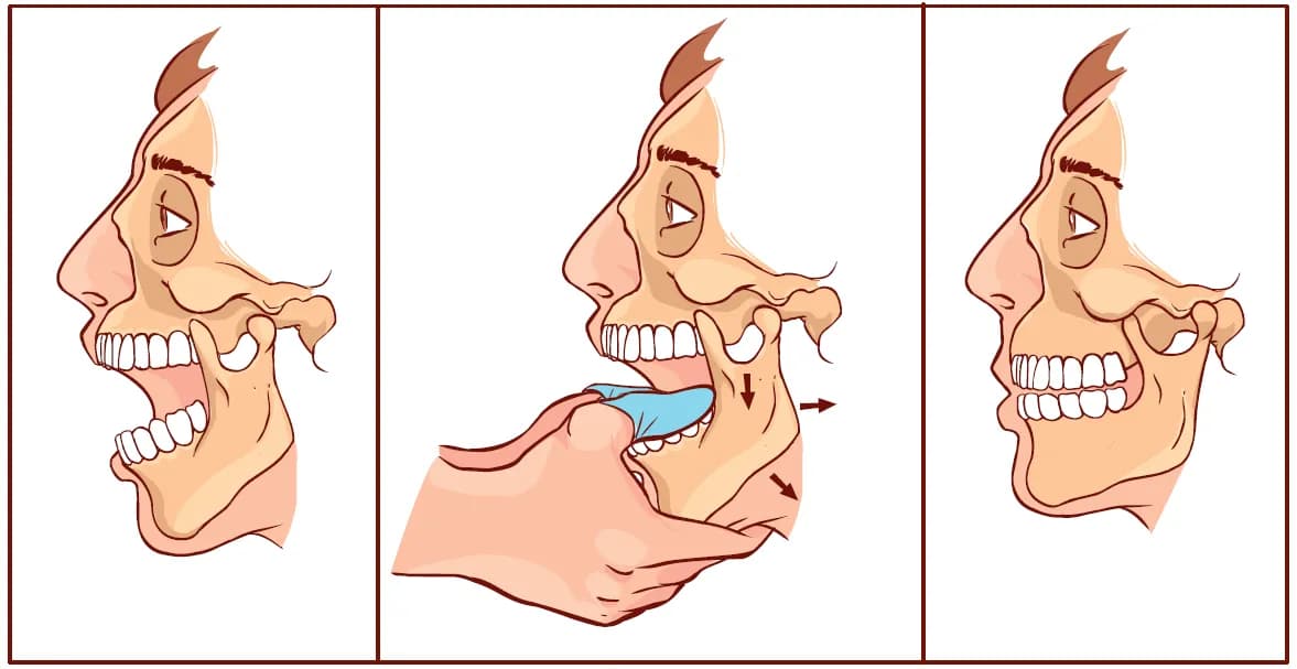 Objawy nowotworu stawu skroniowo-żuchwowego, których nie możesz zignorować